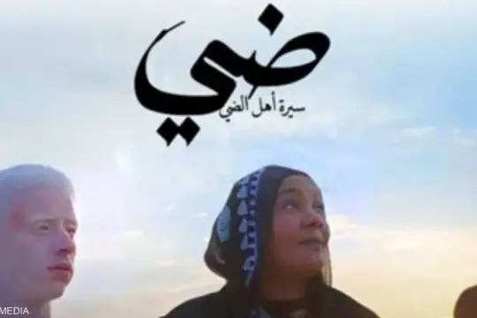 مصر.. فيلم ضي يتناول مرض "الألبينو" بمشاركة محمد منير