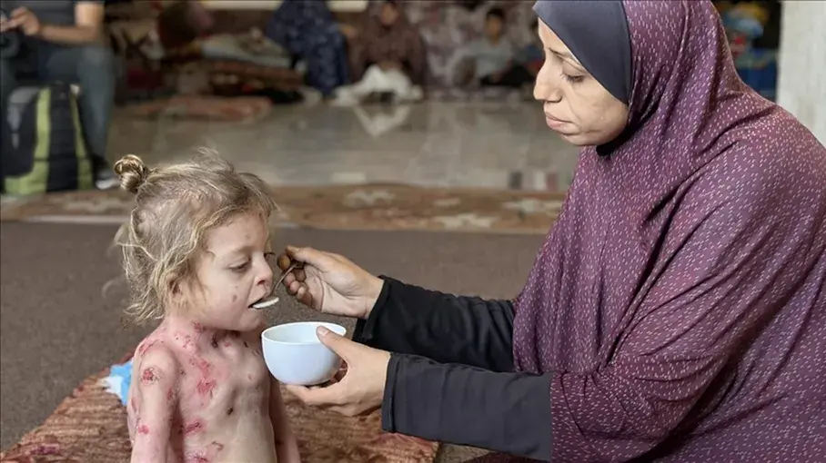 المرض ينهش جسد الطفلة نور على وقع القتل والمجاعة في غزة