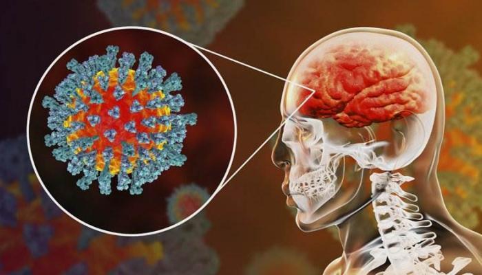 علامات مهمة تنذر بمهاجمة فيروس كورونا للدماغ لا تتجاهلها