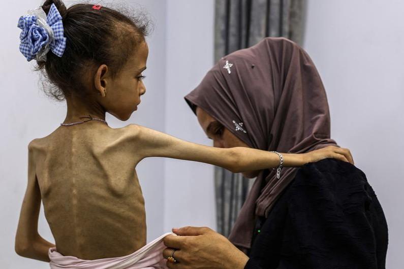 استطلاع: 47% من الإسرائيليين ينفون وجود مجاعة في غزة