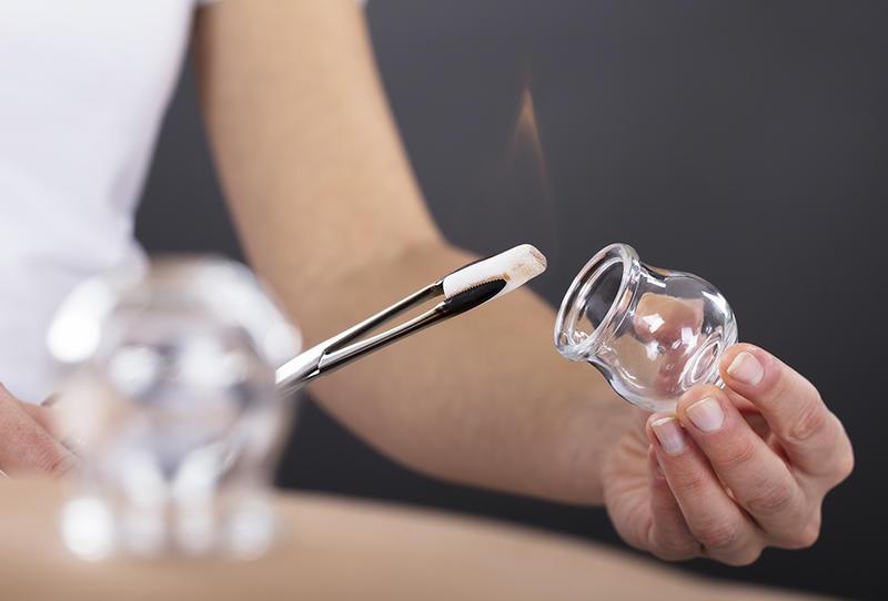 فوائد مذهلة للحجامة إليكم أنواعها