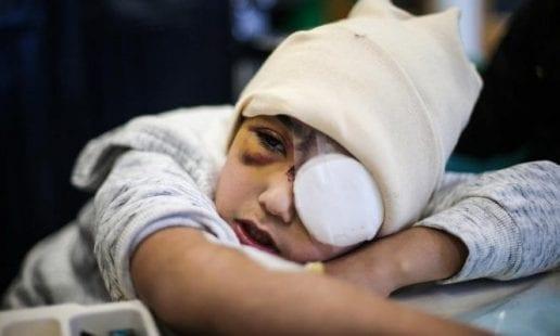 رصاصة الاحتلال غيرت حياة الطفل مالك عيسى من القدس المحتلة