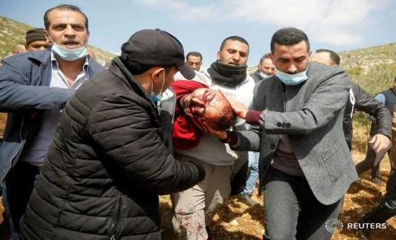 استشهاد فلسطيني جراء إصابته برصاص الاحتلال شرقي نابلس