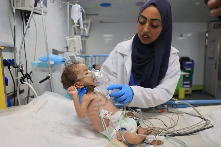 استشهاد طفلة جراء سوء التغذية وتفاقم التجويع بغزة