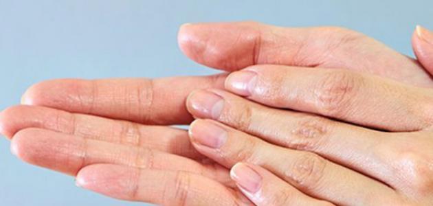 تعرّق القدمين واليدين .. أسباب الظاهرة وكيفية السيطرة عليها