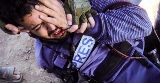 الصحفي عطية درويش يفقد عينه اليسرى "كلياً"
