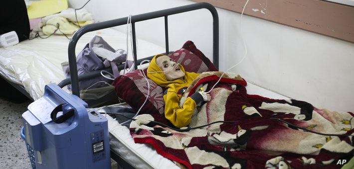 وفاة 4 مواطنين بينهم طفلان بسبب الجوع وسوء التغذية في شمال قطاع غزة